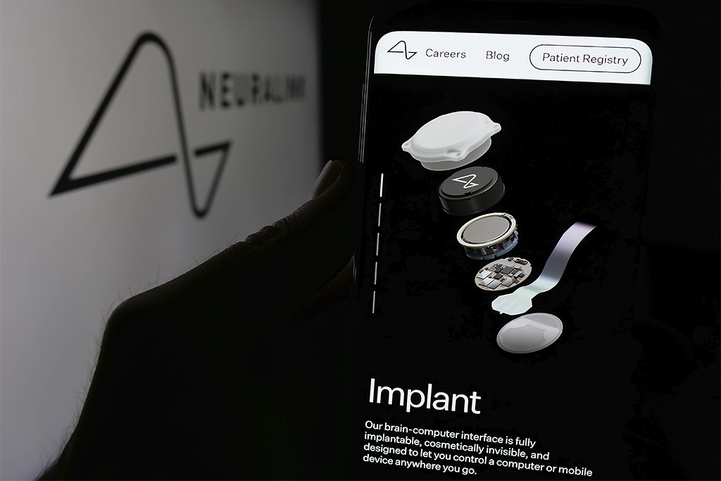 chips cerebrales Neuralink controlados por un teléfono